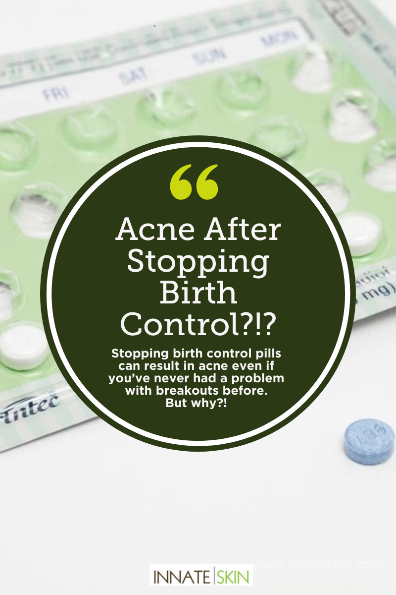 Acne Breakouts After Stopping Birth Control How To Manage Innate Skin