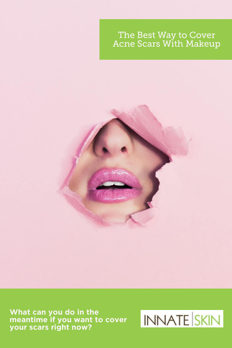 Best Way to Cover Acne Scars With Makeup