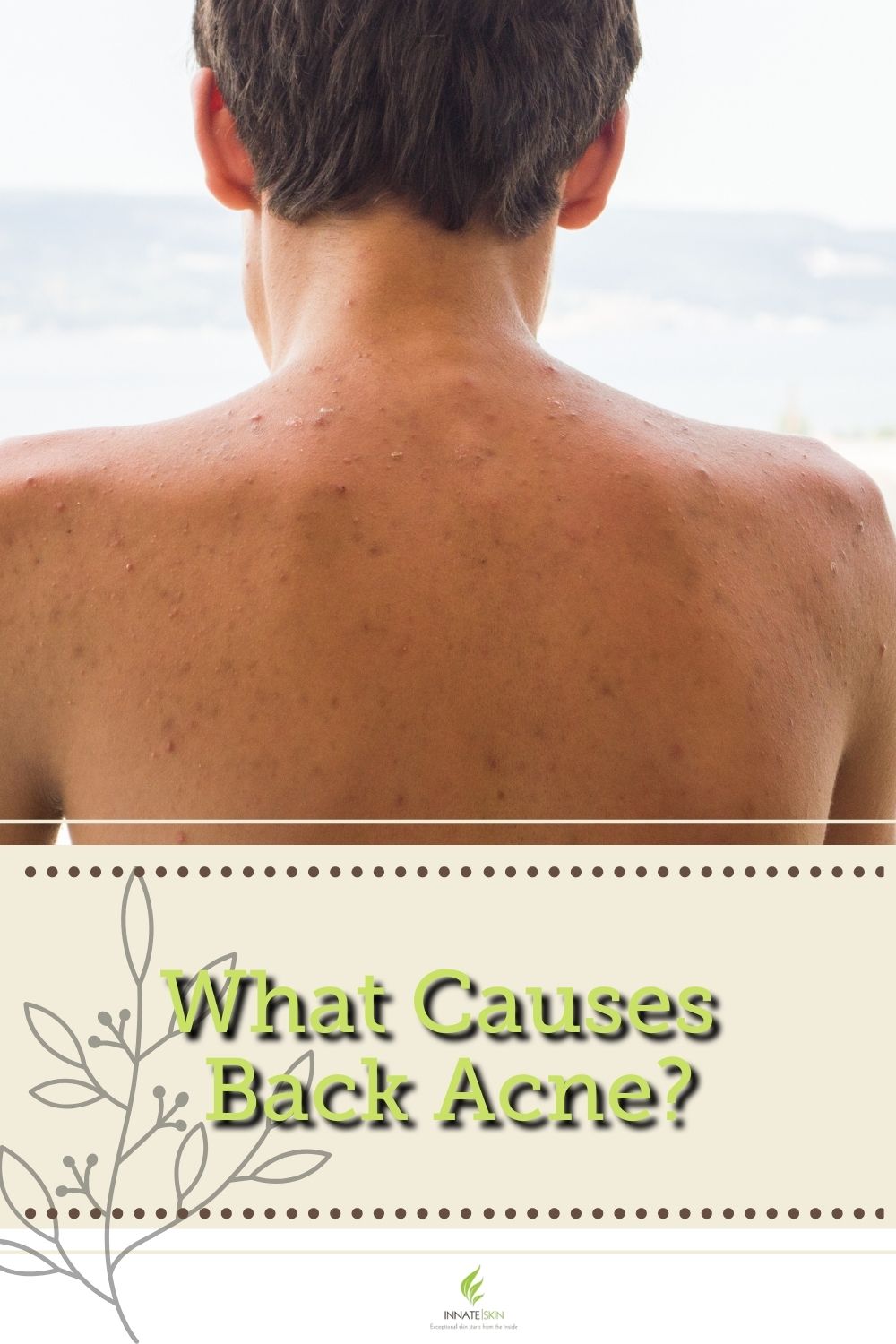 7 Ways to Treat and Prevent Your Back Acne